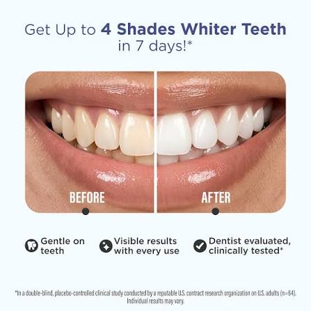 GuruNanda Premium Whitening Strips